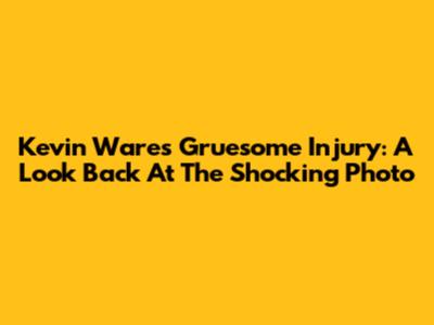 Kevin Ware's Gruesome Injury: A Look Back At The Shocking Photo