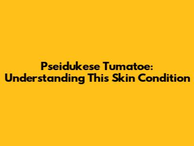 Pseidukese Tumatoe: Understanding This Skin Condition